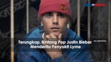 Terungkap, Bintang Pop Justin Bieber Menderita Penyakit Lyme