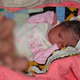 Bayi dengan enam kaki lahir di Pakistan