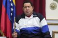 Presiden Hugo Chavez derita komplikasi baru