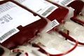 Bank darah tak memadai, 3 ibu hamil meninggal dunia
