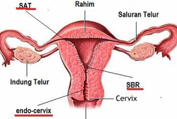 Perempuan Jepara rentan idap kanker mulut rahim