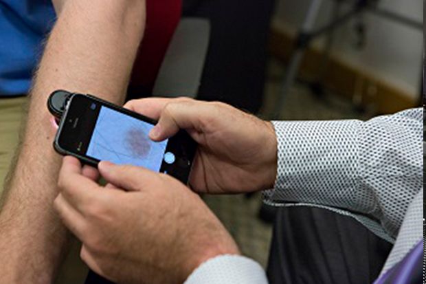 Aplikasi iPhone dapat deteksi kanker kulit