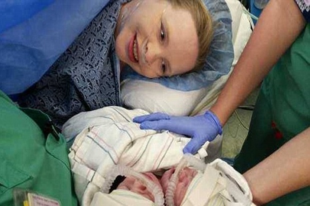 Bayi Kembar Siam di Atlanta, Dua Jiwa Satu Hati