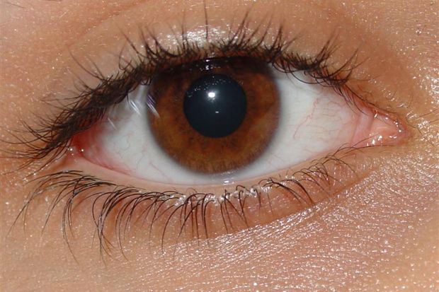 Herpes Zoster Menimbulkan Komplikasi pada Mata