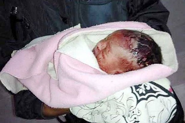 Dibuang di Tong Sampah, Bayi di India Dimangsa Semut