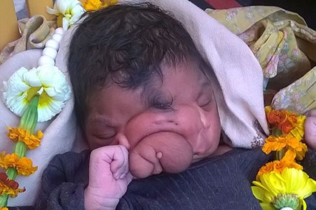 Bayi di India Disembah karena Memiliki Belalai Gajah
