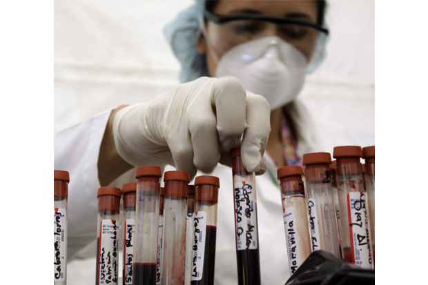 Harapan Baru Vaksin Pencegah HIV