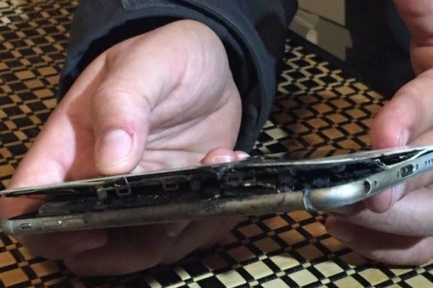 iPhone Pria Ini Terbakar Dalam Kantong Celana