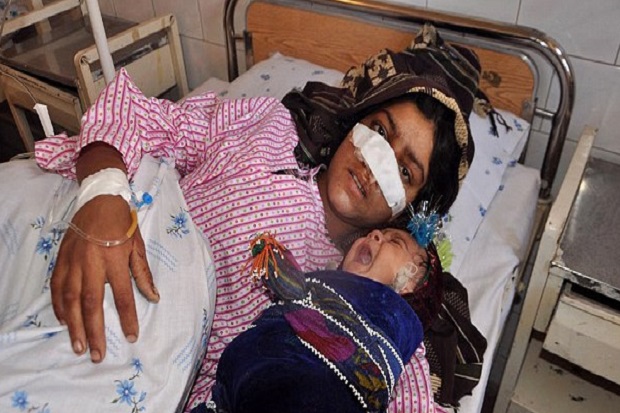 Pria Afghanistan Mutilasi Hidung Istri setelah Nikahi Gadis 7 Tahun