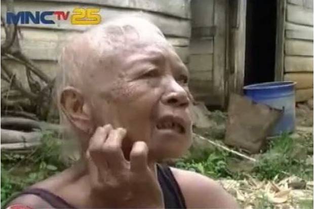 Nenek yang Telinganya Digerogoti Belatung hanya Makan Singkong