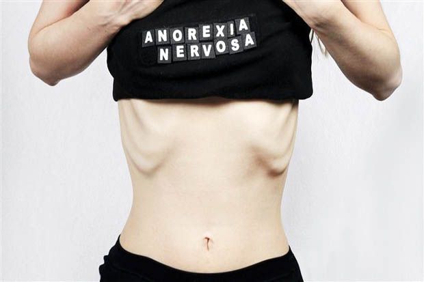 11 Efek Samping ini Terjadi pada Tubuh Penderita Anoreksia