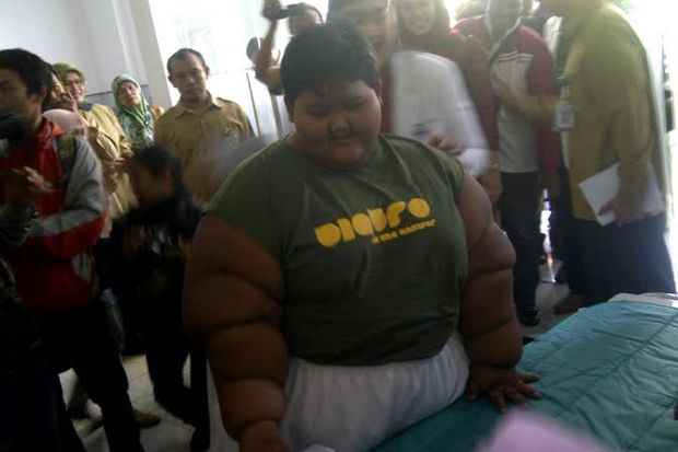 Bocah Obesitas Asal Karawang Dirawat di RSHS Bandung