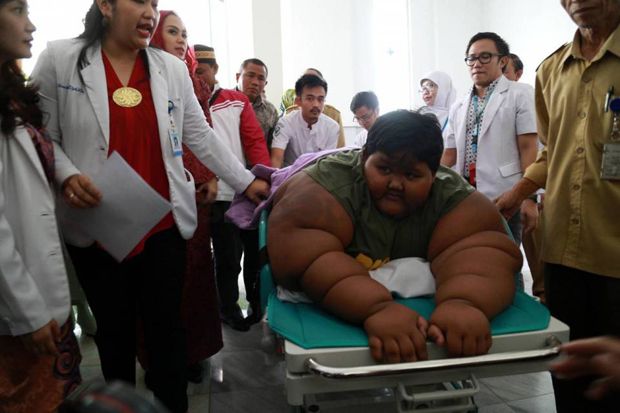 Arya si Bocah Obesitas Kesulitan Tidur di Ranjang