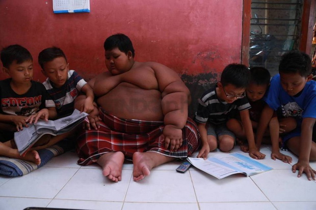 Arya Bocah Obesitas Bercita-cita Jadi Masinis