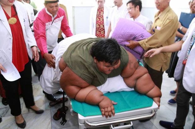 Alasan RSHS Izinkan Bocah Obesitas Pulang ke Karawang