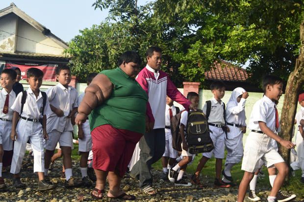 Arya Permana Bocah Obesitas Ingin Jadi Masinis
