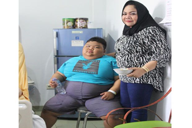 10-15% Anak di Palembang Cenderung Obesitas