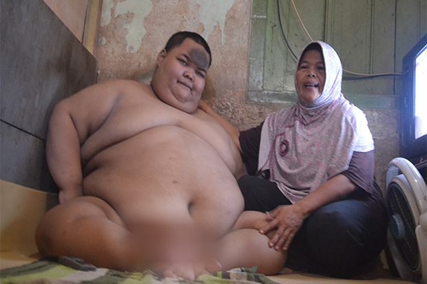 Menderita Obesitas sejak Kecil, Wahid Zarnanda Butuh Bantuan