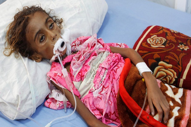Korban Perang Yaman, Gadis 7 Tahun Meninggal usai Kelaparan