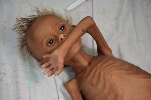 Ramadan di Yaman: Puasa Seharian, Kelaparan Jelang Malam