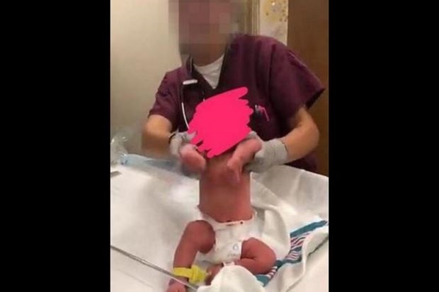 Posting Foto Bayi Baru Lahir dengan Sebutan Setan Mini, RS AS Dihujat