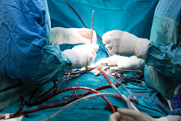 Studi: Operasi Jantung Baiknya Dilakukan Siang Hari