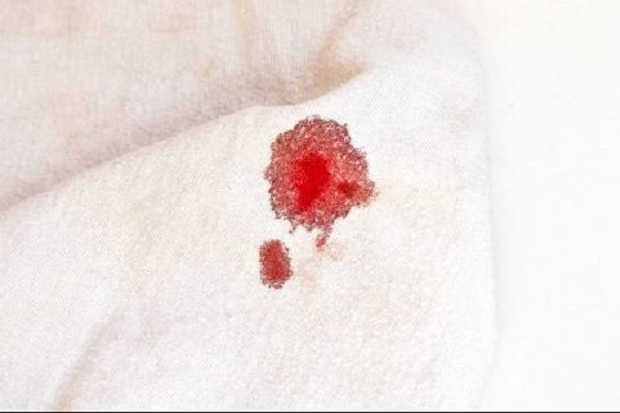 4 Alasan Keluar Bercak Darah, meski Tak Menstruasi