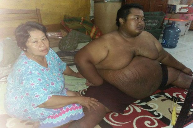 Dibantu Pemda, Penderita Obesitas Dibawa ke RSUD Karawang
