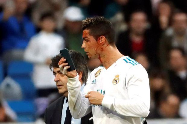 Zidane Bela Ronaldo Selfie Pakai Ponsel Dokter