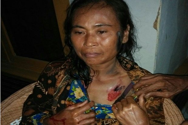 Polda Jabar Back Up Polres Sukabumi Usut Penembakan Ibu Atikah