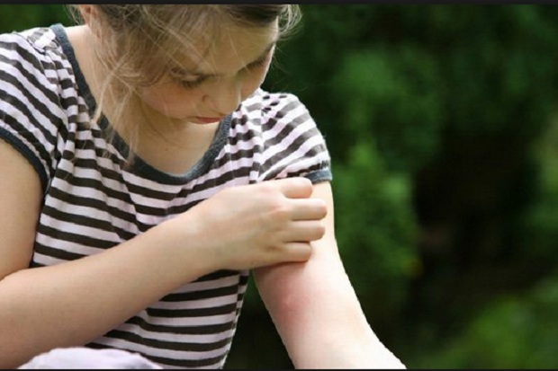 Tips Mencegah Alergi pada Anak