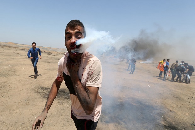 Horor, Tabung Gas Air Mata Israel Tertancap di Pipi Pria Palestina