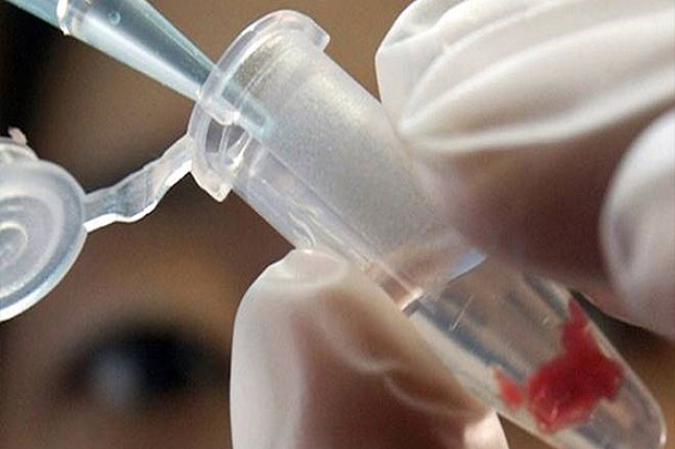 Remaja Prancis Suntik Tubuhnya dengan DNA dari Alquran