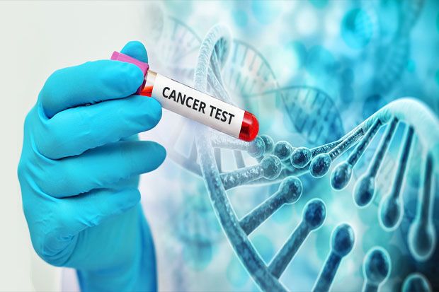 Peneliti Kembangkan Tes 10 Menit untuk Deteksi Kanker
