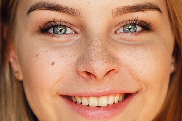 5 Cara Alami Menghilangkan Bintik-bintik di Wajah