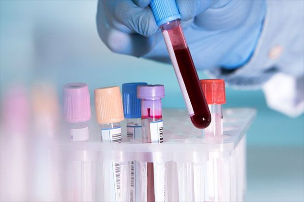 Tes Darah Baru Diharapkan Bantu Deteksi Dini Kanker Ovarium