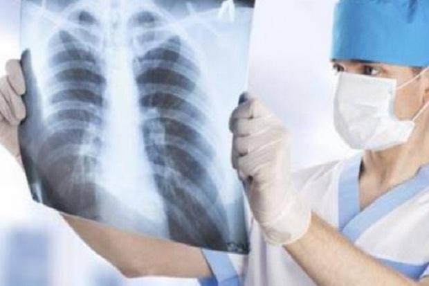 5 Gejala TBC yang Harus Segera Ditangani Dokter
