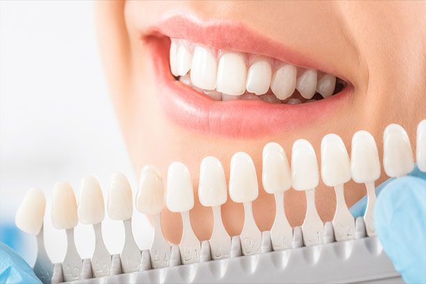 Bahan Aktif Pemutih Gigi Bisa Merusak Lapisan Dalam Gigi