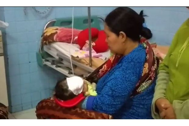 Bayi Berumur 40 Hari Terluka Parah Diserang Kera Liar