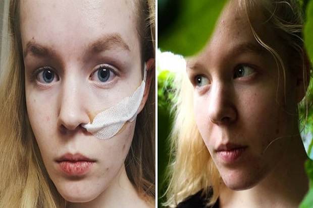Trauma Diperkosa, Permohonan Suntik Mati Gadis Belanda Dikabulkan
