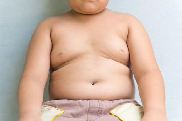 Ada Risiko Fisik dan Mental bagi Anak yang Alami Obesitas