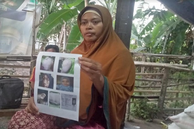 Berangkat Ilegal, TKW asal Lombok Diduga Dianiaya di Arab Saudi