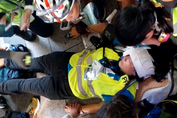 Jurnalis Indonesia yang Ditembak dalam Demo Hong Kong Alami Kebutaan
