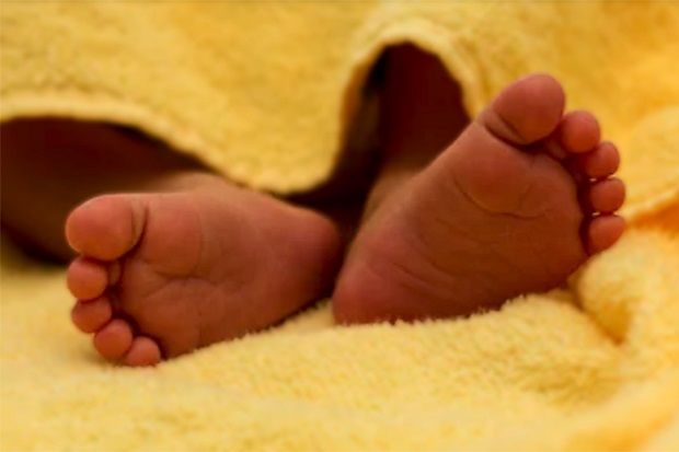 Ditarik Dokter saat Kelahiran, Kepala Bayi di Namibia Putus