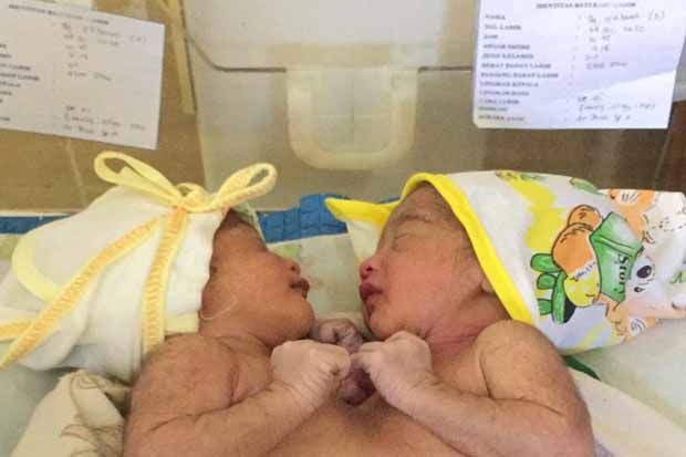 Bayi Kembar Dempet Dada di Pangkalan Bun Butuh Uluran Tangan Donatur