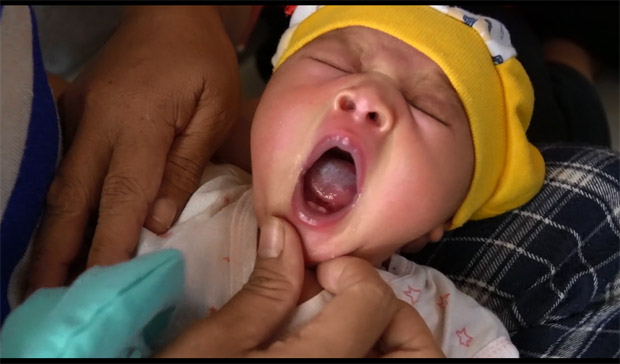 Tak Lazim, Bayi Baru Lahir Tumbuh Gigi di Busel Bikin Heboh