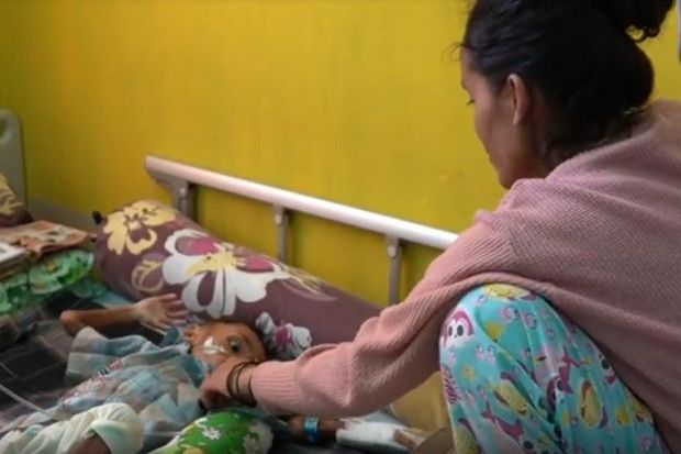 Miris, Bocah 3 Tahun di Buton Selatan Derita Gizi Buruk