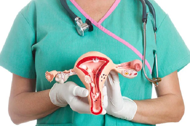 Kenali Tanda dan Gejala Kanker Endometrium, Wanita Tak Boleh Abaikan