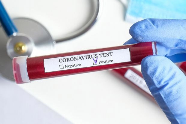 Terus Meluas, Wabah Virus Corona Sentuh Afrika Selatan