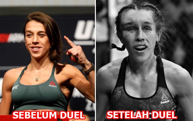 Wajah Wanita Ini Rusak akibat Duel Brutal UFC di Las Vegas